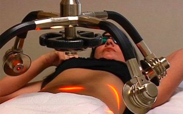 Lipo Laser Machine: A Shining Star in Revolutionary Fat Management Technology