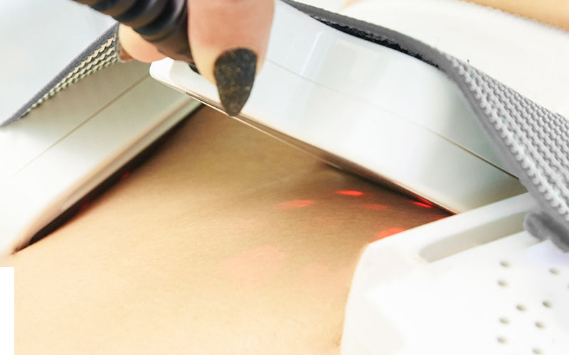 Understanding Green Laser Treatment A Comprehensive Guide