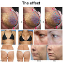 6 In 1 Multifunctional 40KHz Cavitation RF Equipment Weight Loss Butt Vacuum Machine Butt Cupping Machine Breast Lifting Machine