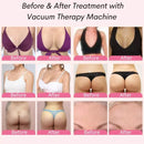 Hands-Free Body Sculpting Vacuum Therapy Machine with XL Cups