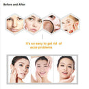 Oxygen Facial Machine Consumables Gel