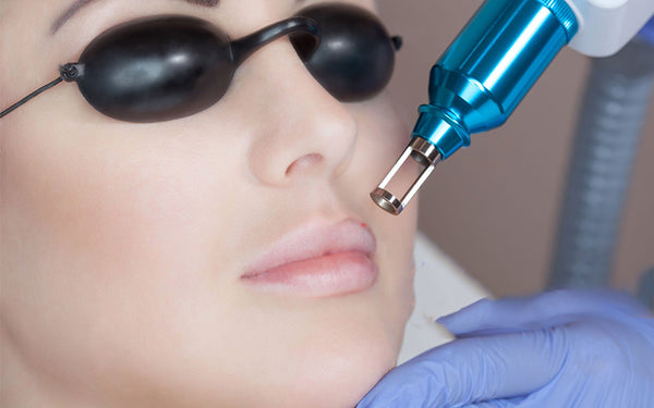 Understanding the Permanence of Laser Hair Removal Burns