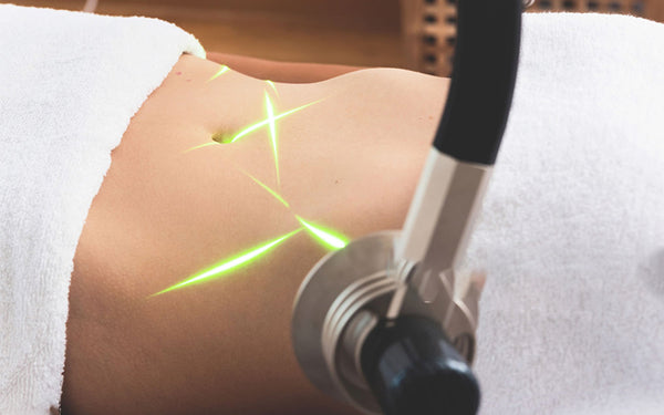 Exploring Lipo Laser for Weight Loss