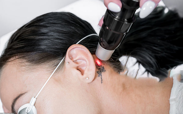Does Laser Tattoo Removal Scar: The Complete Guide