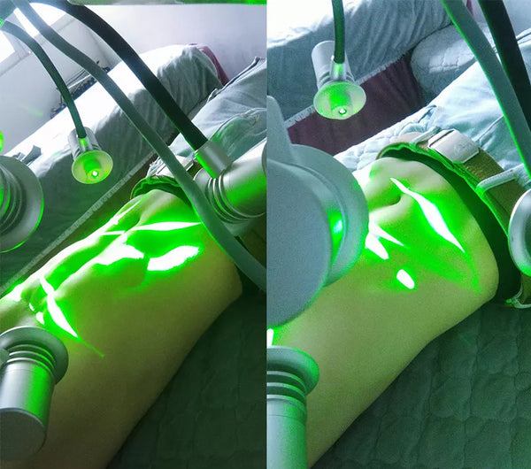 Lipo Laser: Is It Safe and Effective for Body Contouring?