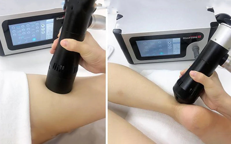 Application of Shockwave Therapy Machine in ED (Erectile Dysfunction) Treatment