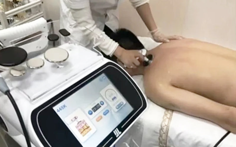 Explore Smart TECAR Wave: A new chapter in beauty with revolutionary electrotherapy technology