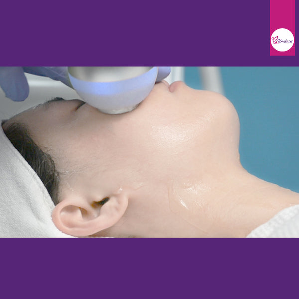 Is Cryoskin Permanent?