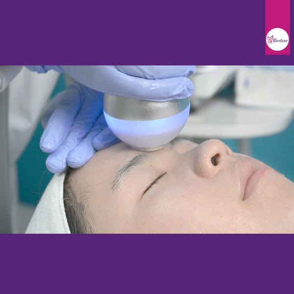 How Long Does Cryoskin last?