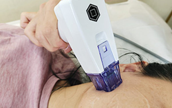 What is Morpheus 8 Fractional RF Microneedling and How Does It Work?