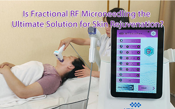 Is Fractional RF Microneedling the Ultimate Solution for Skin Rejuvenation?