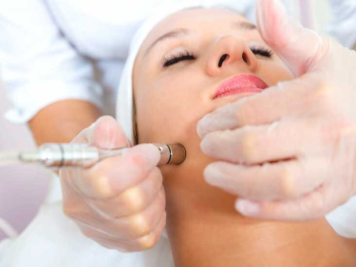 What Can Microdermabrasion Machine Do?