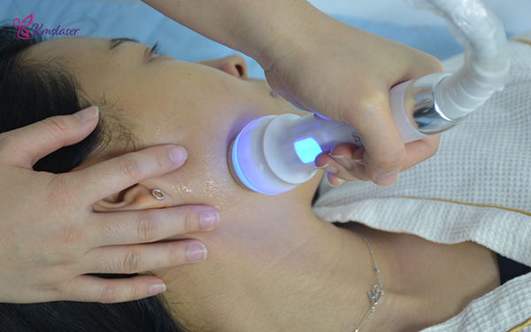 Cryoskin Facial: How It Works & What Are Its Benefits?