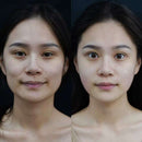 New Design 12D Beauty SPA 22D 3 In1 Machine Firming and Burning Fat Firming and Slimming Multifunctional Private Parts Machine