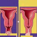 New Design 12D Beauty SPA 22D 3 In1 Machine Firming and Burning Fat Firming and Slimming Multifunctional Private Parts Machine