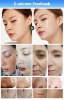 Multifunctional EMS RF Facial Skin Tightening Machine 15 In 1 Hydra Diamond Dermabrasion For SPA Facial Beauty