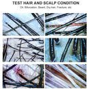 Skin Analyzer 50X/200X Magnifier Analyzer HD Skin Scanner Hair Follicle Oil Moisture Pigment Tester Scalp