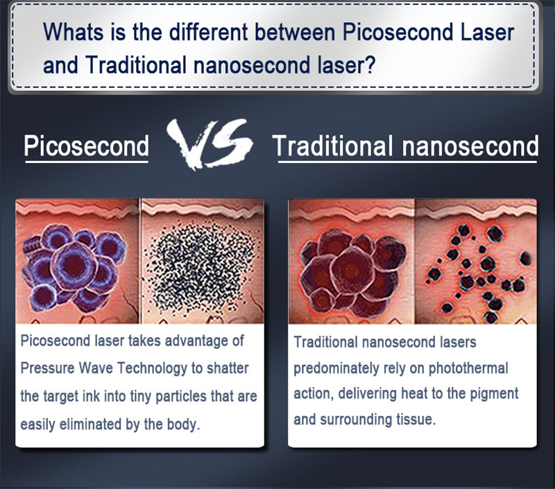 professional tattoo removal pico q switched picosecond laser carbon tattoo removal pico carbon picotech laser