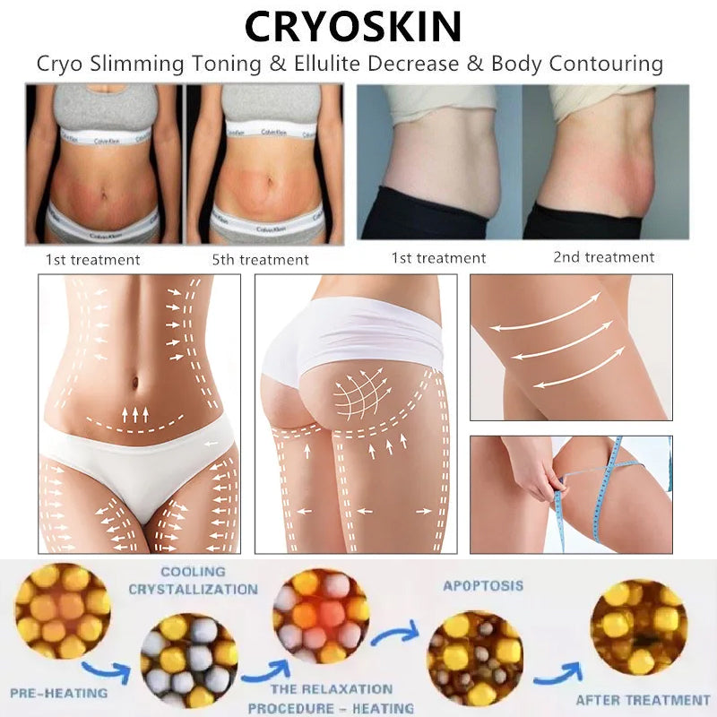 Cryoskin Cool Shock Thermal System Skin Firming Cryo skin Beauty Machine