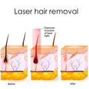 2 in 1 picosecond nd yag laser carbon peel tattoo removal device 808 diode spa equipment hair removal Beauty machine aesthetic