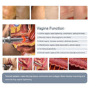 CO2 Fractional Laser Acne Scar Removal Stretch Marks Skin Tightening Machine Spa