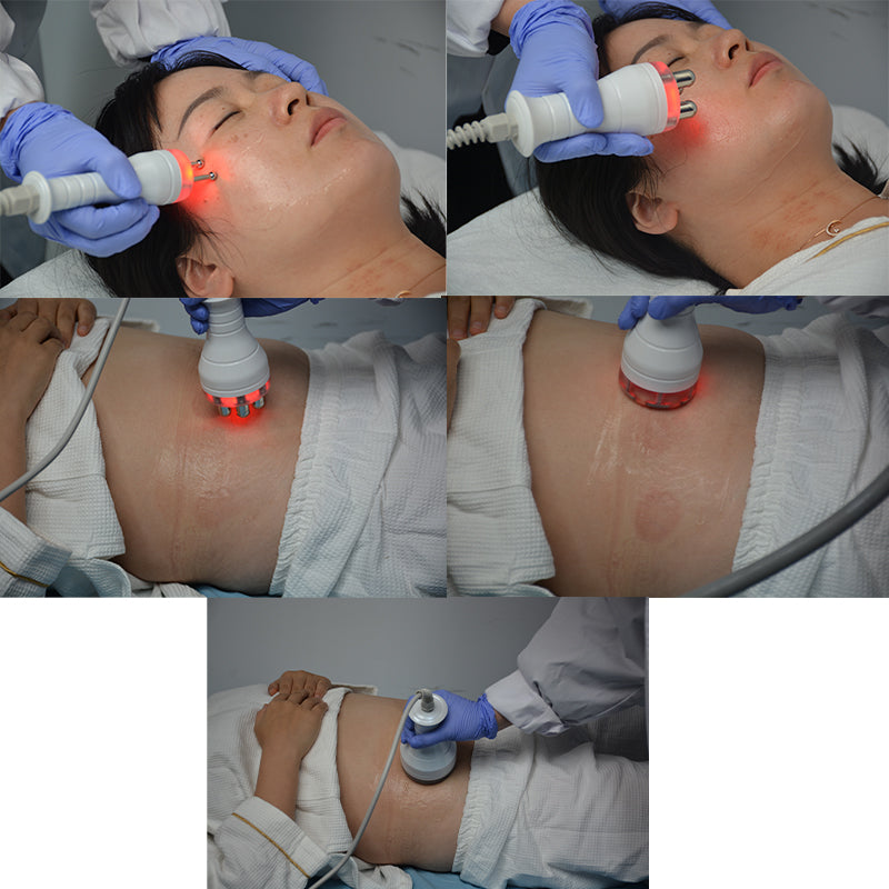 Radiofrequency Skin Tightening Facial Rejuvenation Machine CA01