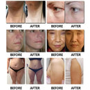 80khz Cavitation Beauty Equipment 6 In 1 Cavitation RF Machine For Weight Loss And Body Liposuction Slimming