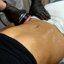 6 in 1 Cavitation Vacuum RF System for Face and Body