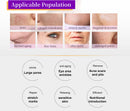 A70 Third-Generation CryoM9 Ice Gold RF Microcrystal Beauty Device – Multi-Layer Deep Skin Rejuvenation & Anti-Aging System