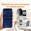 AI Skin & Scalp Analyzer – Analysis Reports Viewable on Mobile Phone via App | KMSLASER