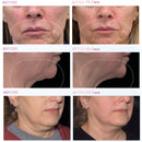 New Trending Non-Invasion Emslim Wrinkle Removal Electromagnetic Muscle Building Face Lifting Skin Tightening Machine