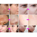 Professional 10 In 1 Hydra Microdermabrasion H2O2 Facial Machine RF Bubble Deep Cleaning Facial Skin Pores