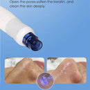 Jet Peel Facial Machine Aqua Win OEM Jet Peel Facial Machine T55