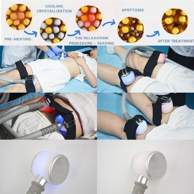 Top Cryotherapy Cryo skin Cooling Cryoskin Tightening Thermal T Shock System fat reduction Beauty devices body slim care machine