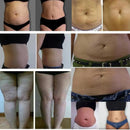 C10 KMSLASER Cryotherapy Cryoskin Cool Skin Tightening Cryo Thermal Tshock Face Body Beauty Device