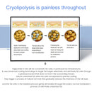 C10 KMSLASER Cryotherapy Cryoskin Cool Skin Tightening Cryo Thermal Tshock Face Body Beauty Device