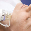 Portable RF Fractional Wrinkle Removal Skin Tightening Micro Lift Machine Anti Wrinkle Acne