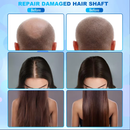 KMSLASER Hair Loss Treatment Growth 2 HD Detector Heads Scalp Analysis Device Hair Analyzer Machine For Hair Loss Scalp Massager