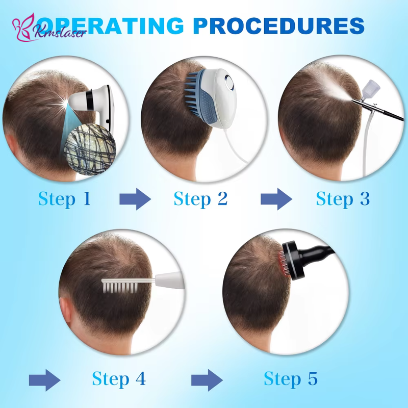 KMSLASER hair loss treatment growth 2 HD detector heads scalp analysis device hair analyzer machine for hair loss scalp massager