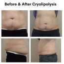 360 Fat Burncyro Lipolysis Therapy Freeze Machine Portable Cool Tech Cold Cryofrequency Sculpting Cyrotherapy Slimming Equipment