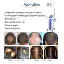 Regaine Hair Regrowth Laser Treatment Alopecia Injection Spray Derma Machine For Hair Regrowth Products Solution
