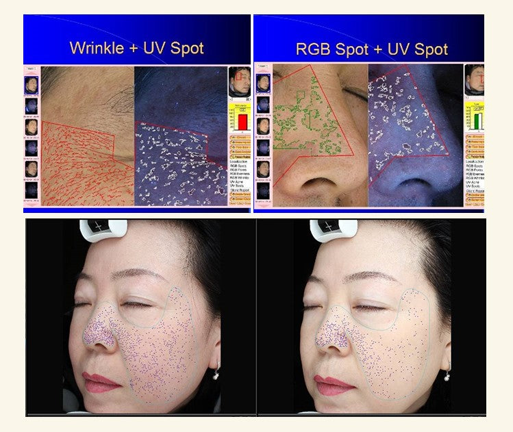 3D Magic Mirror Facial Skin Analyzer/3d Face Camera Skin Analyzer Machine 3d Face Scanner