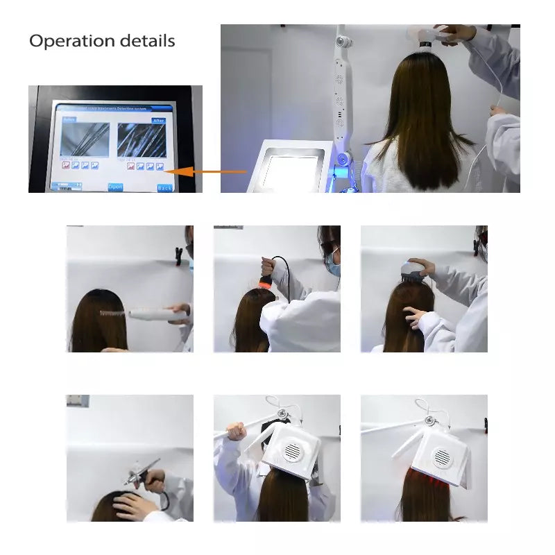 190/400 pcs Diode laser Hair Loss Treatment Grow Growth Laser Equipment 650nm Hair Light Regrowth Machine no LED