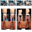 EMS Body Hi Slim Muscle Sculpt Stimulation EMS Body Stimulator Emshaping EMT EMS 2 Handles Sculpting Machine