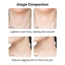 Face & Neck Skin Rejuvenation Bundle