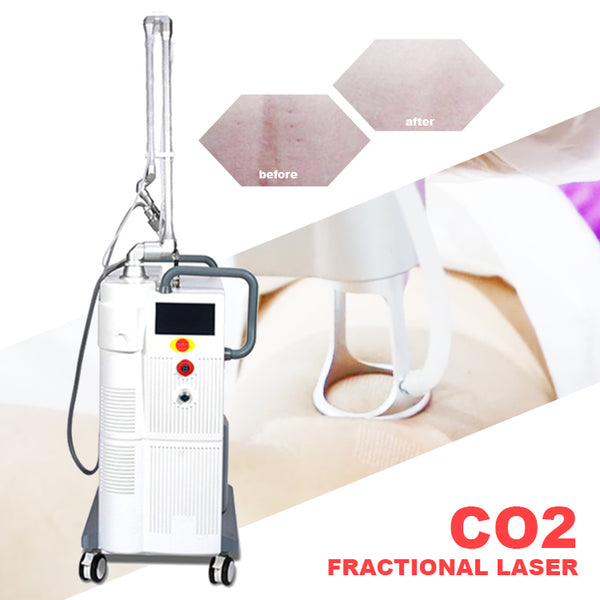 Acne Scar Removal Pen Cutting Machine Glass Rf Tube Engraving Fractional Co2 Laser Stretch Marks