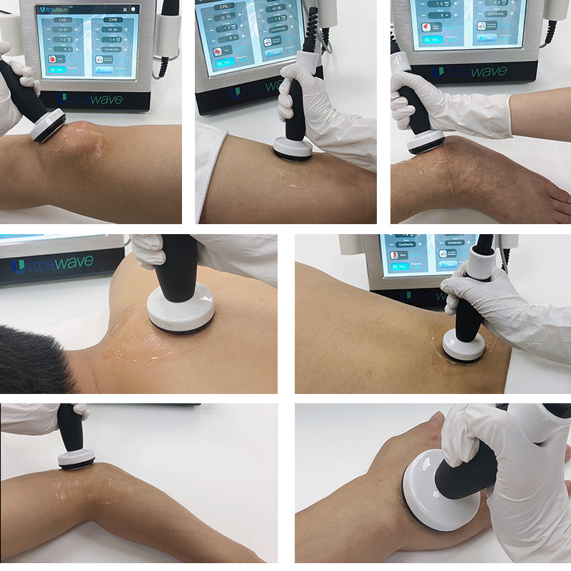 Low Intensity Shockwave Therapy Machine