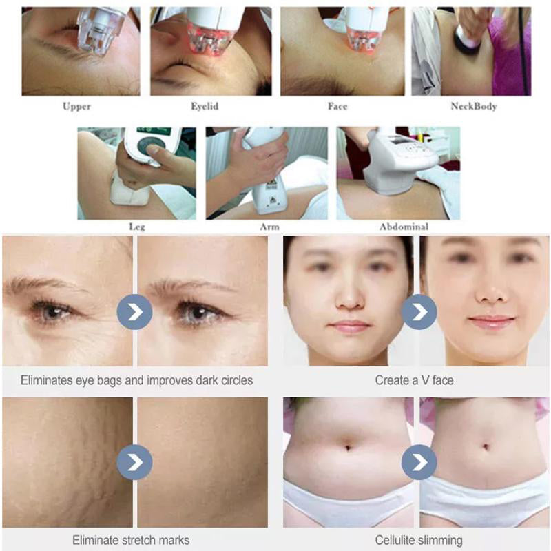 Newest Easy Operating Rf vacuum roller massage skin tightening face lifting Roller body slimming body shape machine